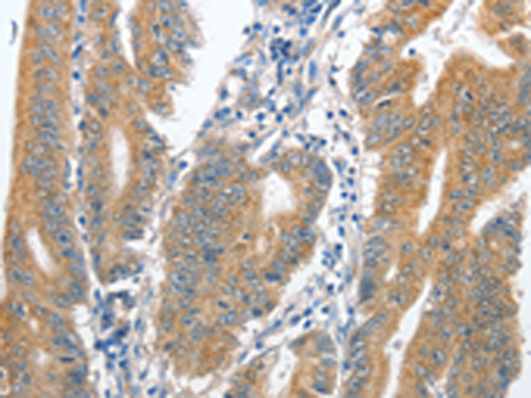 Rabbit Polyclonal Antibody to CENPC