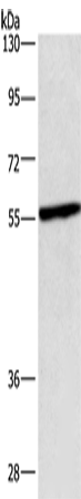 Rabbit Polyclonal Antibody to CEP55