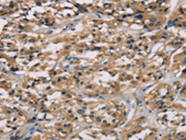 Rabbit Polyclonal Antibody to CGA