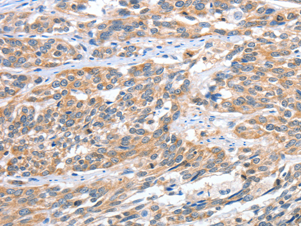 Rabbit Polyclonal Antibody to CGB3
