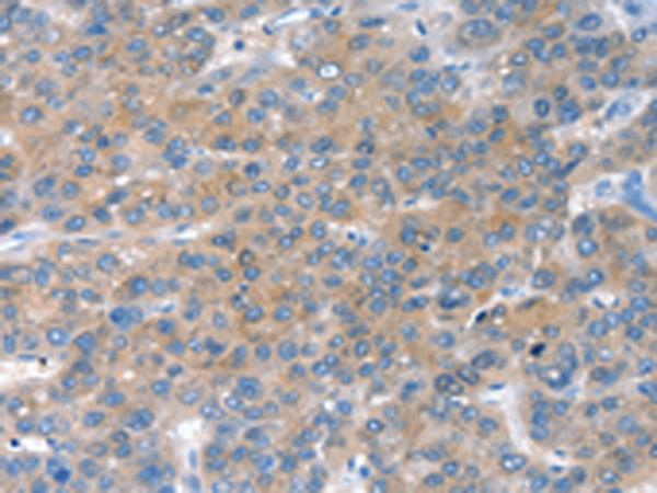 Rabbit Polyclonal Antibody to CHAC1