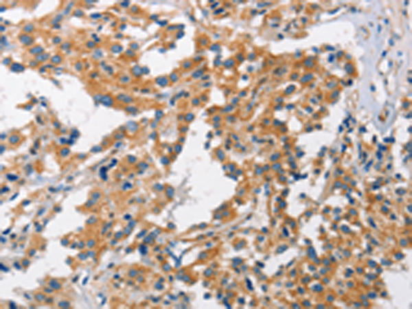 Rabbit Polyclonal Antibody to CHMP1A
