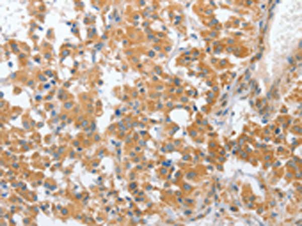 Rabbit Polyclonal Antibody to CHMP4B