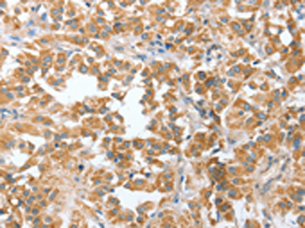 Rabbit Polyclonal Antibody to CIAPIN1
