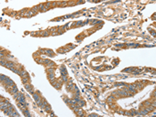 Rabbit Polyclonal Antibody to CKAP2