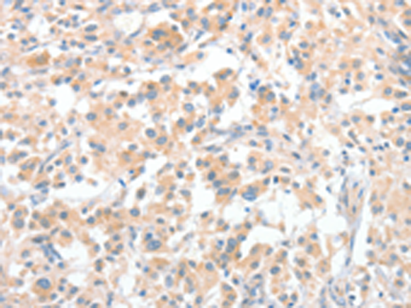 Rabbit Polyclonal Antibody to CLIP1