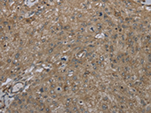 Rabbit Polyclonal Antibody to CLPS