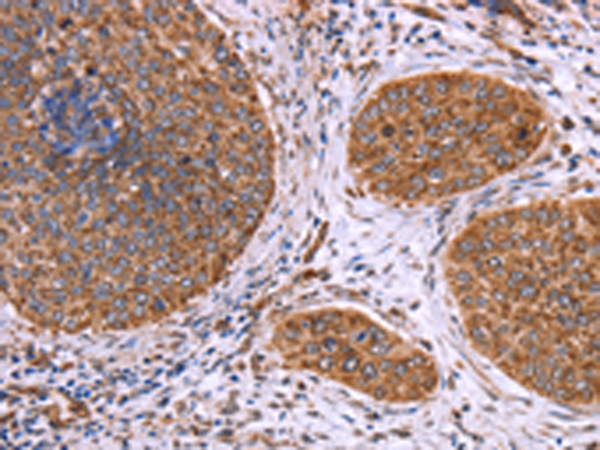 Rabbit Polyclonal Antibody to CLUAP1