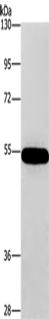 Rabbit Polyclonal Antibody to CNDP1