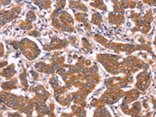 Rabbit Polyclonal Antibody to COL20A1