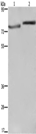 Rabbit Polyclonal Antibody to COMP