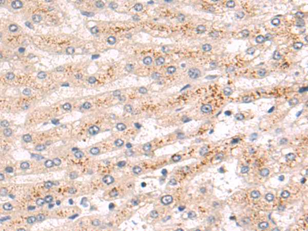 Rabbit Polyclonal Antibody to CORIN
