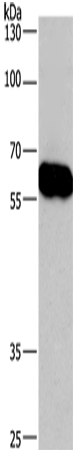 Rabbit Polyclonal Antibody to CORO1C