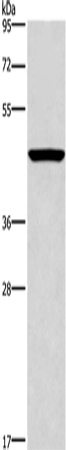 Rabbit Polyclonal Antibody to CPA2