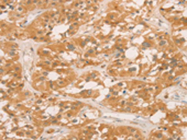 Rabbit Polyclonal Antibody to CPB1