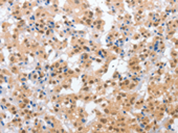 Rabbit Polyclonal Antibody to CPSF4