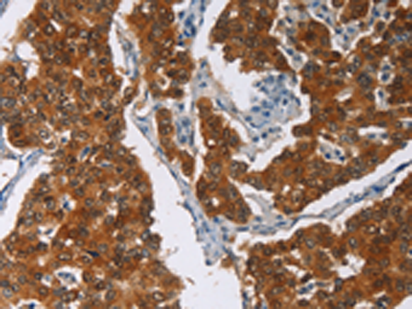 Rabbit Polyclonal Antibody to CRABP2