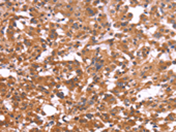 Rabbit Polyclonal Antibody to CRISP3