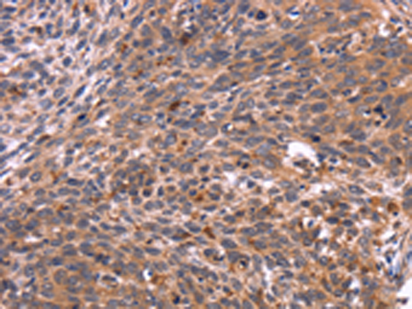 Rabbit Polyclonal Antibody to CRK