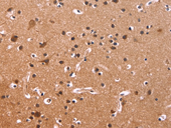 Rabbit Polyclonal Antibody to CSNK1D