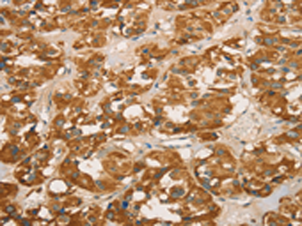 Rabbit Polyclonal Antibody to RBBP8