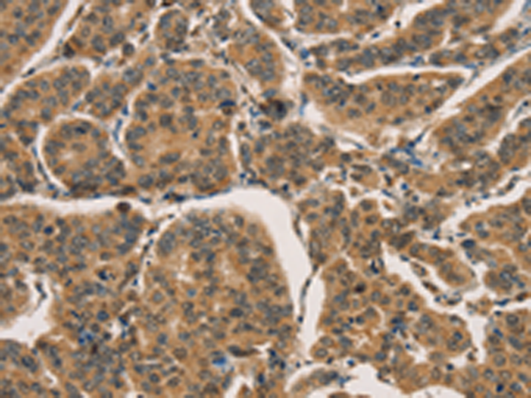 Rabbit Polyclonal Antibody to CTNNBIP1
