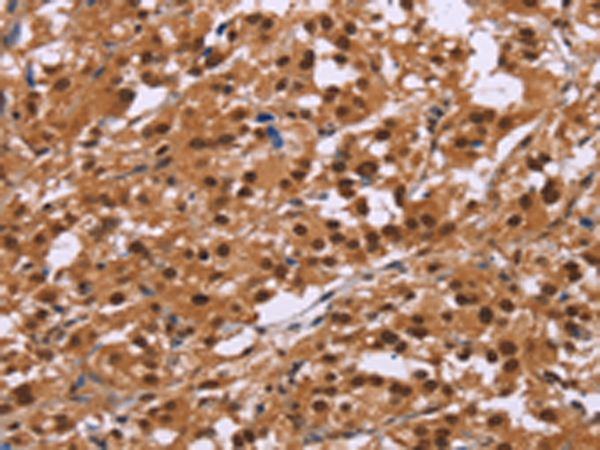 Rabbit Polyclonal Antibody to CTNNBL1