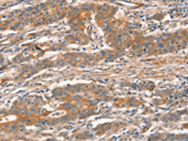 Rabbit Polyclonal Antibody to CUEDC2