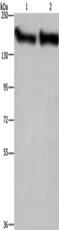Rabbit Polyclonal Antibody to CYFIP2