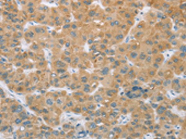 Rabbit Polyclonal Antibody to CYP2C9