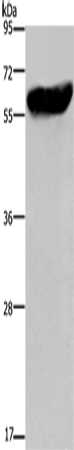 Rabbit Polyclonal Antibody to CYP2E1
