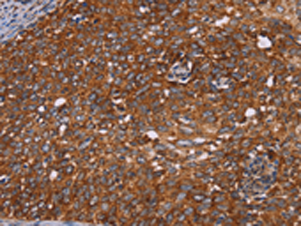 Rabbit Polyclonal Antibody to CYP2W1