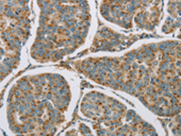 Rabbit Polyclonal Antibody to CYP11B1