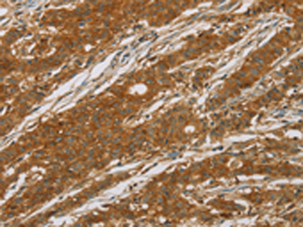 Rabbit Polyclonal Antibody to CYP27A1