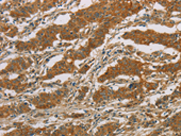 Rabbit Polyclonal Antibody to CYP39A1