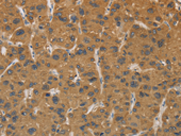 Rabbit Polyclonal Antibody to CYP17A1