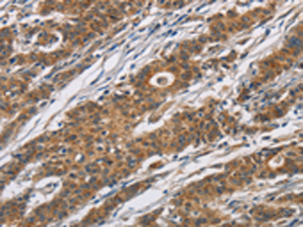 Rabbit Polyclonal Antibody to CYP21A2