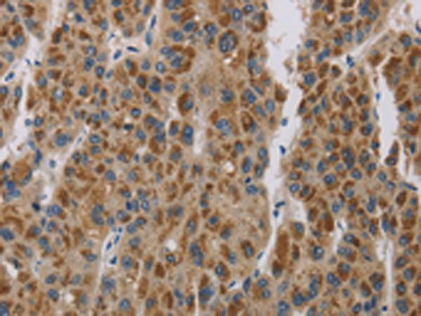 Rabbit Polyclonal Antibody to LOXL4