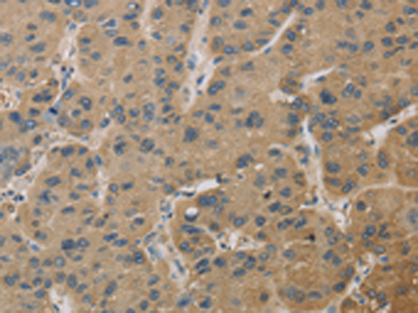 Rabbit Polyclonal Antibody to TBXAS1