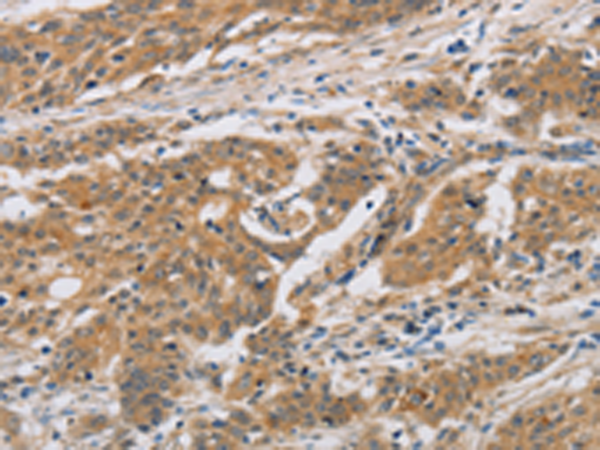 Rabbit Polyclonal Antibody to CST6