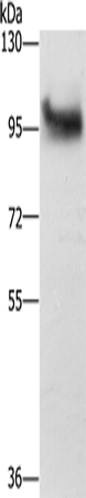 Rabbit Polyclonal Antibody to DAB2