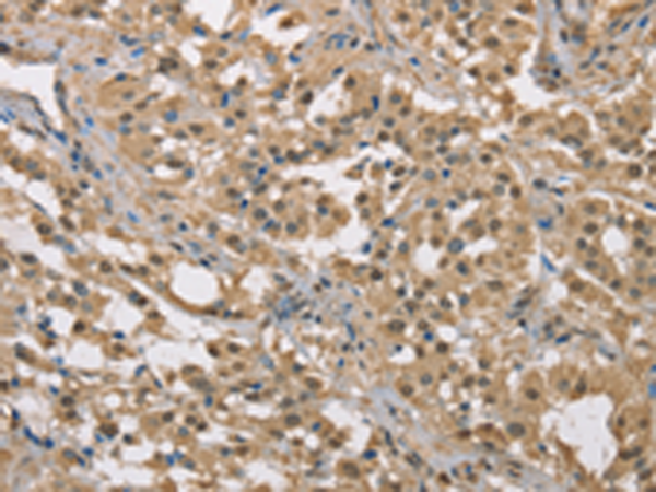 Rabbit Polyclonal Antibody to DACH2