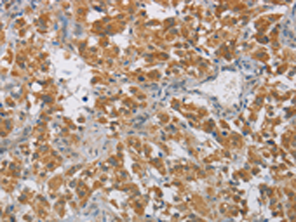 Rabbit Polyclonal Antibody to DIDO1