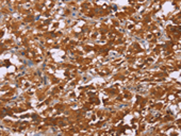 Rabbit Polyclonal Antibody to DCBLD2