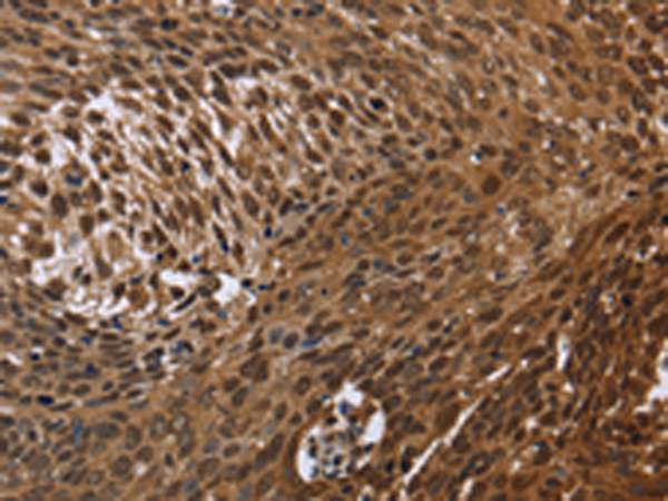 Rabbit Polyclonal Antibody to DCP1A