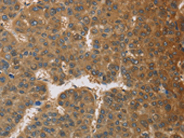Rabbit Polyclonal Antibody to TNFRSF10D
