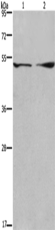 Rabbit Polyclonal Antibody to DCTN2