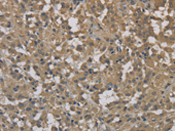 Rabbit Polyclonal Antibody to DCTN3
