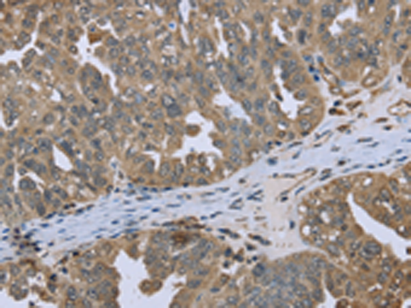 Rabbit Polyclonal Antibody to DCTN4