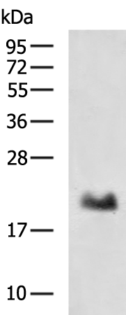 Rabbit Polyclonal Antibody to DCTN5